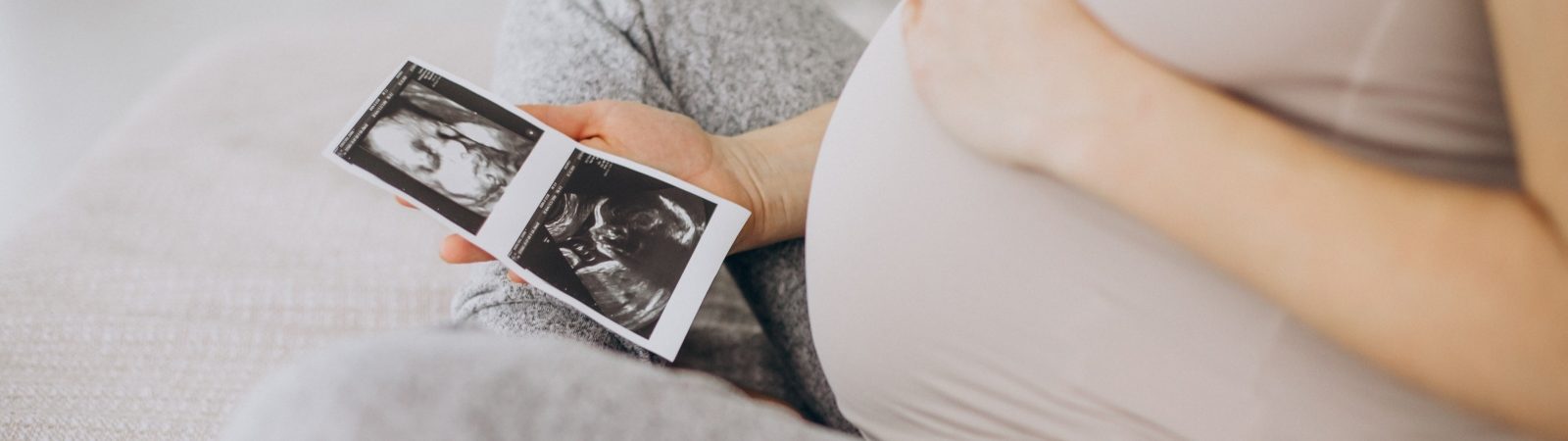 mulher grávida, sentada e segurando uma foto de um ultrassom